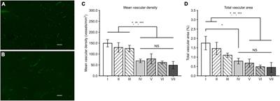 AAV8-mediated sVEGFR2 and sVEGFR3 gene therapy combined with chemotherapy reduces the growth and microvasculature of human ovarian cancer and prolongs the survival in mice